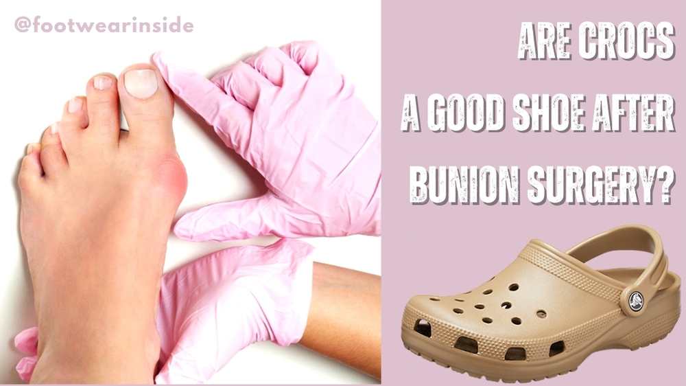 Are Crocs A Good Shoe After Bunion Surgery Enjoy Painless Walk!