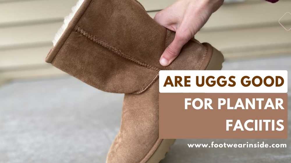 Are uggs good for plantar fasciitis? 1 Are uggs good for plantar fasciitis – The Ultimate Guide to Wearing Uggs with Plantar Fasciitis