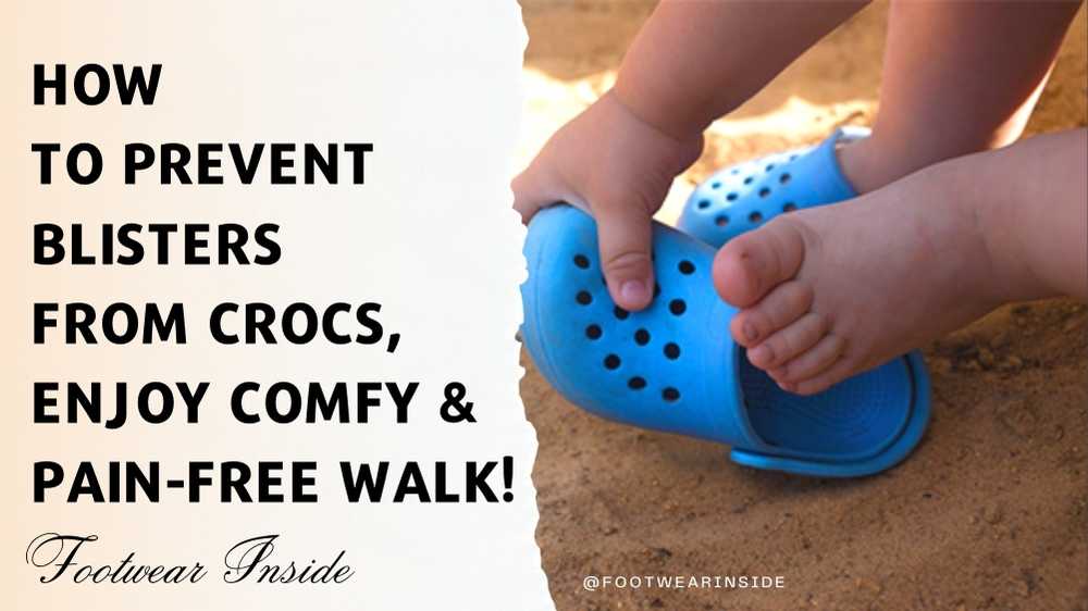 How To Prevent Blisters From Crocs Enjoy Comfy & Pain-free Walk!